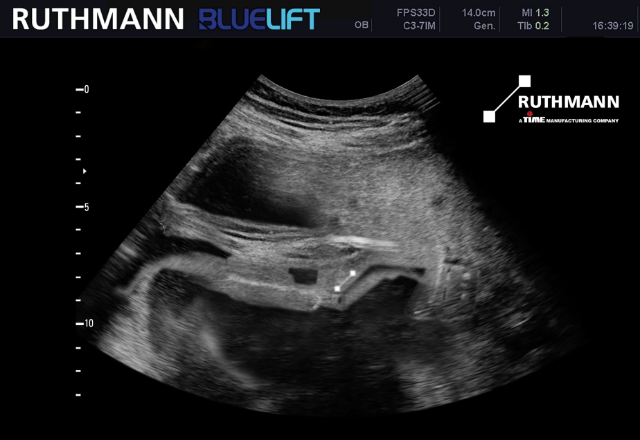 Das frisch geborene RUTHMANN BLUELIFT „Baby“ wird auf en Platformers‘ Days vorgestellt.